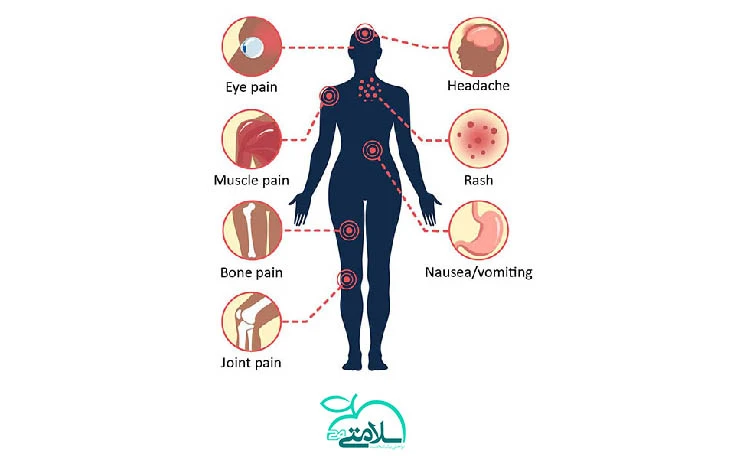 تمام آنچه که باید درباره تب دنگی بدانید